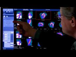 medicine nucléaire stations xeleris 7